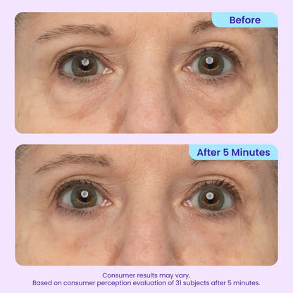 ✨Mopiri Instant Lift Eye Gel - For the look of Puffiness & Bags, Wrinkles, Fine Lines and Dark Circles