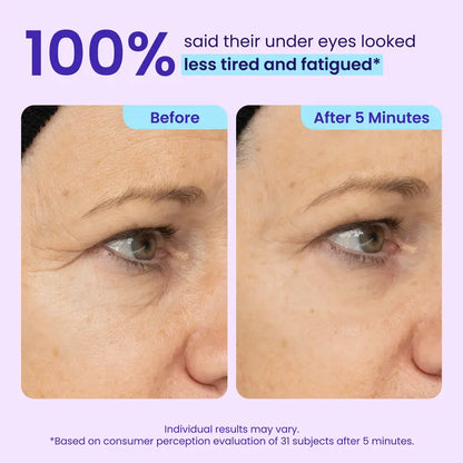 ✨Mopiri Instant Lift Eye Gel - For the look of Puffiness & Bags, Wrinkles, Fine Lines and Dark Circles