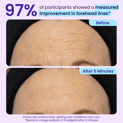 ✨Mopiri Instant Lift Eye Gel - For the look of Puffiness & Bags, Wrinkles, Fine Lines and Dark Circles